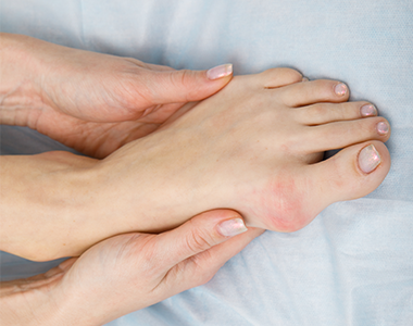 Face à l’hallux valgus la riposte du podologue