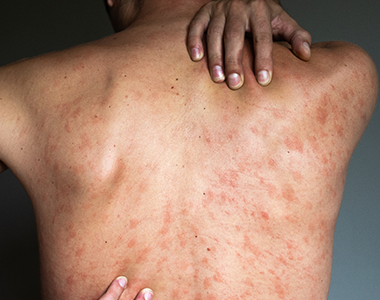 Tous ces avis dermatos