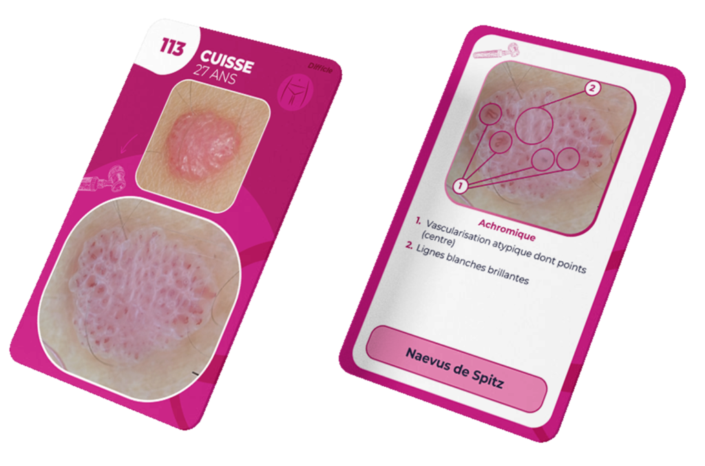 mockup flashcard_3