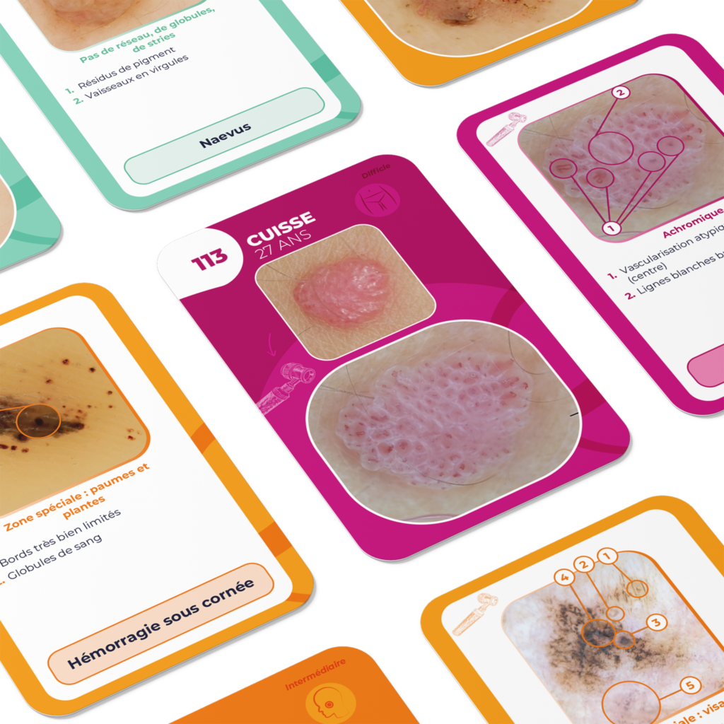 Flashcards dermoscopie